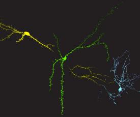 Source nsf.gov: Credit: Marina Maksimova and Julian Meeks, Department of Neuroscience, UT Southwestern Medical Center